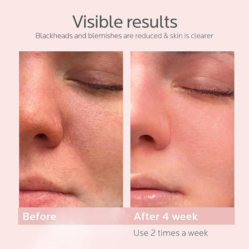 FreshBloom® - Nano Ionic Beauty Wand