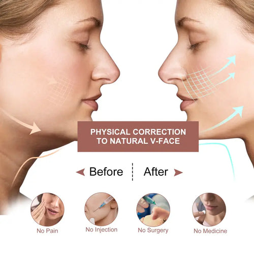 VContour® - Double Chin Reducer V Line Face Lifting Tape