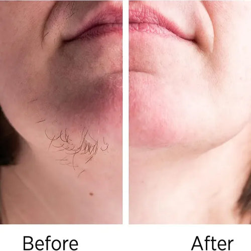 GlowEdge® – 2-in-1 Eyebrow & Facial Shaver